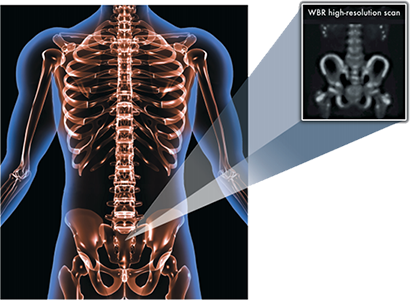 spect bone scan