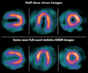 Cardiac scan